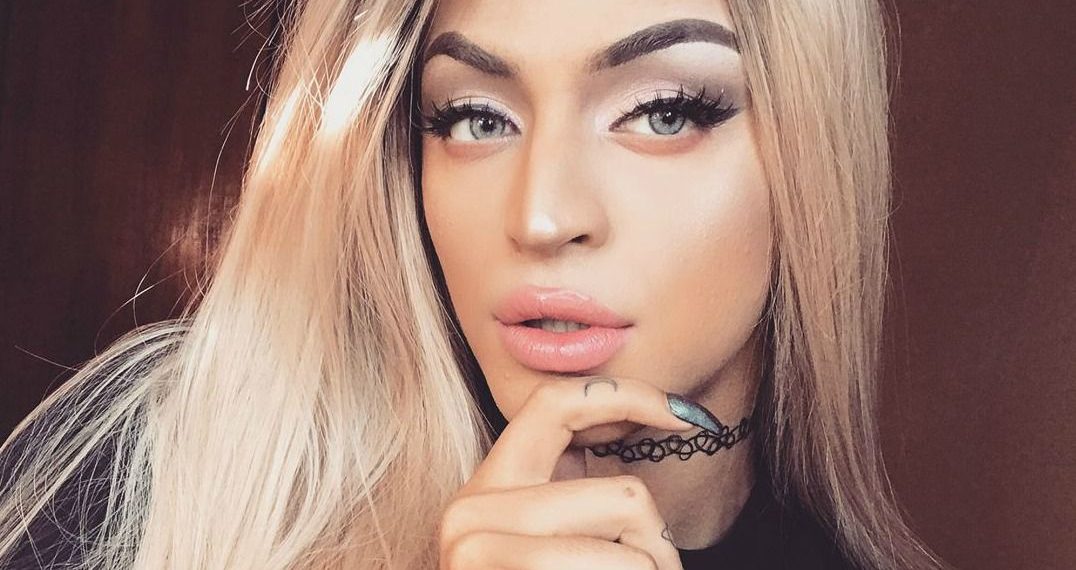 Pabllo Vittar surge nas redes sociais com olho roxo e curativo